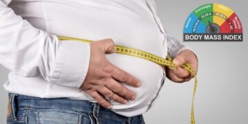 BMI and Obesity