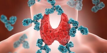 What is Thyroiditis